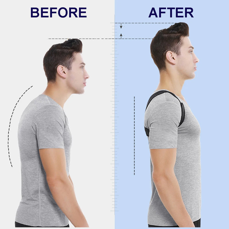 Posture Corrector Clavicle Spine Back Belt Adjustable Unisex Upper Back Shoulder Lumbar Posture Correction