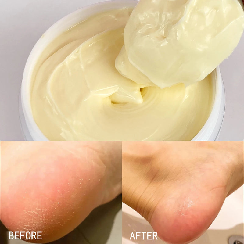 AILKE Whitening Remove Black Spots Facial Skin Care Lotion Moisturizing Cream Body Glutathion Vitamin C Black Skin Face New Set